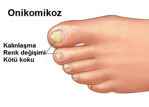 AYAKLARINIZA TARÇIN SÜRERSENİZ BAKIN NE OLUYOR ? O DERDE TEK DEVA BUYMUŞ galerisi resim 6