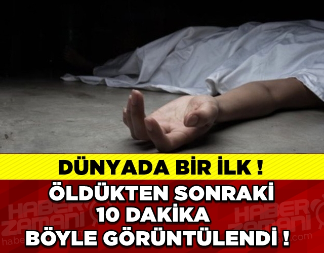 HASTANIN ÖLÜMÜNDEN SONRA ÖYLE ŞEYLER OLDU Kİ... galerisi resim 1