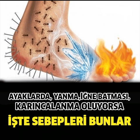 Ayaklarda , Yanma , Karıncalanma Oluyorsa Sebepleri Bunlar... galerisi resim 1