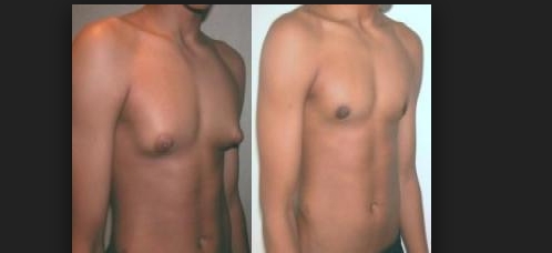 BU İLACI SAKIN KULLANMAYIN EVİNİZDE VARSA HEMEN ATIN galerisi resim 7