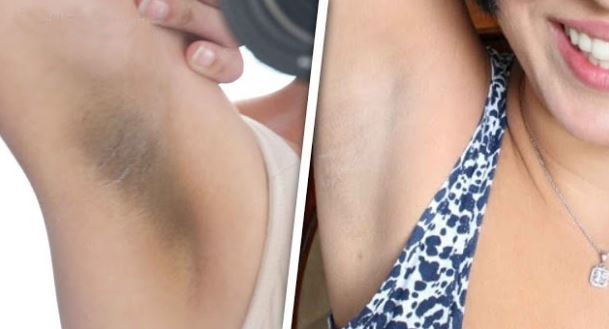 Koltuk Altınıza Patates Rendesi Uygulayın neden mi?: galerisi resim 1