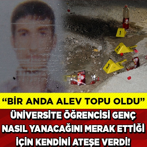 FECİ OLAY! ÜNİVERSİTE ÖĞRENCİSİ KENDİNİ BÖYLE YAKTI galerisi resim 1