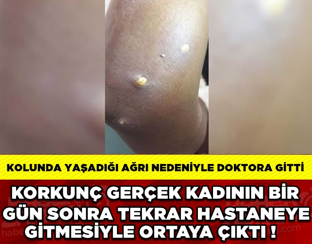 46 YAŞINDAKİ KADININ KOLUNDAN ÖYLE BİR ŞEY ÇIKTI Kİ ! galerisi resim 1