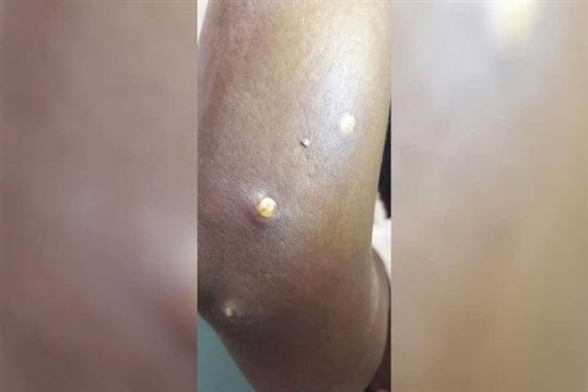 46 YAŞINDAKİ KADININ KOLUNDAN ÖYLE BİR ŞEY ÇIKTI Kİ ! galerisi resim 2