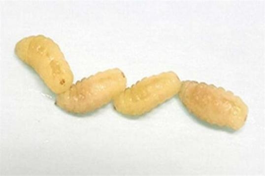 46 YAŞINDAKİ KADININ KOLUNDAN ÖYLE BİR ŞEY ÇIKTI Kİ ! galerisi resim 3