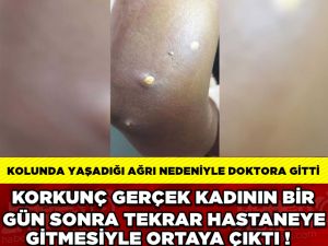 46 YAŞINDAKİ KADININ KOLUNDAN ÖYLE BİR ŞEY ÇIKTI Kİ !