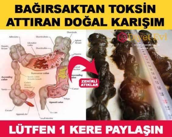 ÇAĞIN EN BÜYÜK SORUNU BAĞIRSAKLARIMIZDA galerisi resim 1