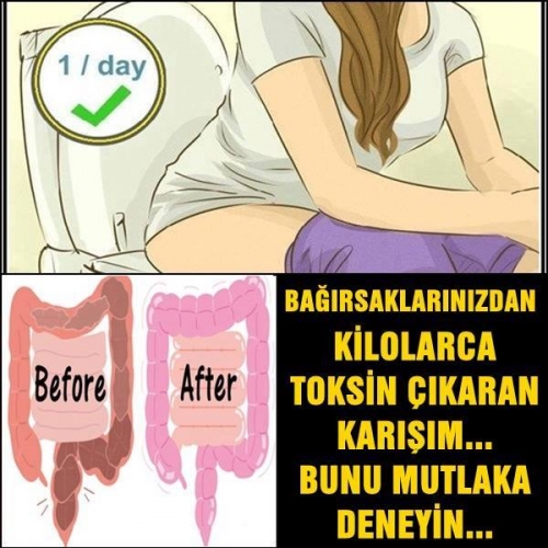 ÇAĞIN EN BÜYÜK SORUNU BAĞIRSAKLARIMIZDA galerisi resim 2