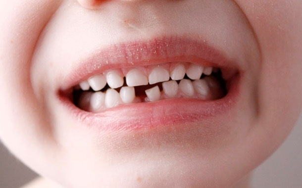 Tıp dünyasından gelen bildiri: Çocuklarınızın süt dişlerini atmayın! galerisi resim 5