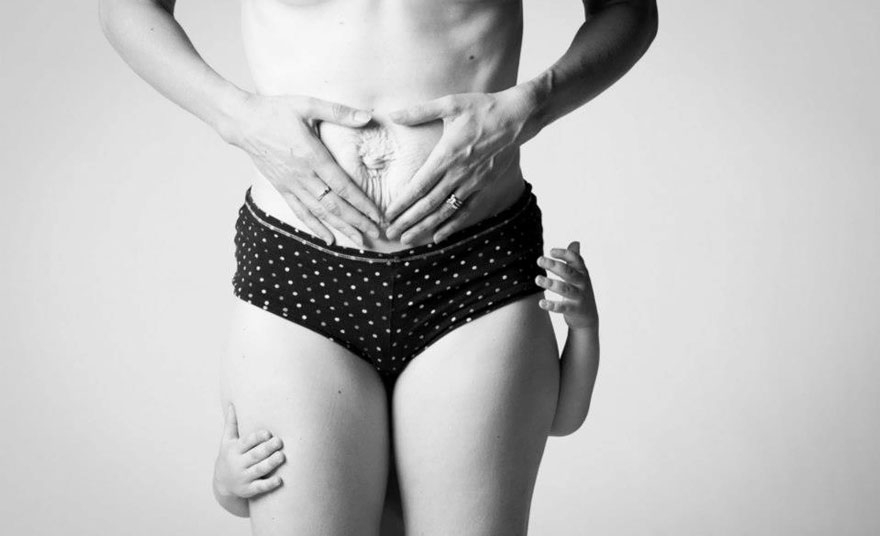 Doğum Sonrası Kadın Vücudunun Ne Hale Geldiğini Gösteren 14 Fotoğraf galerisi resim 14