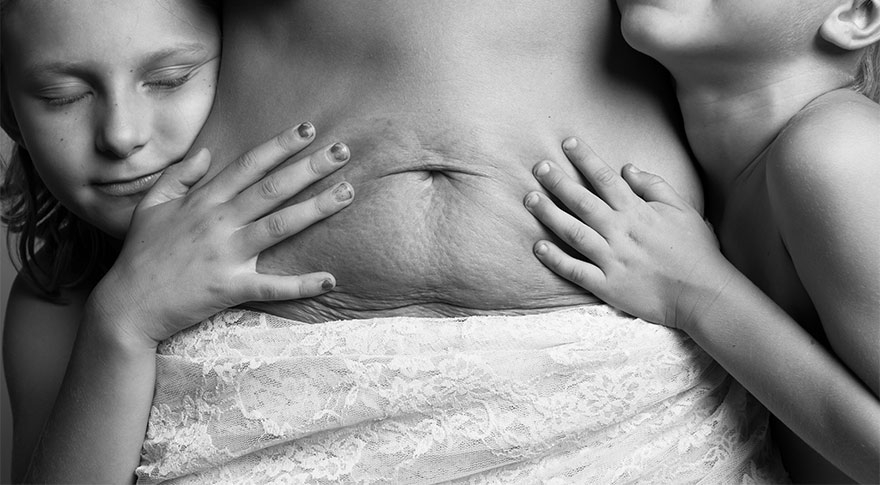 Doğum Sonrası Kadın Vücudunun Ne Hale Geldiğini Gösteren 14 Fotoğraf galerisi resim 2