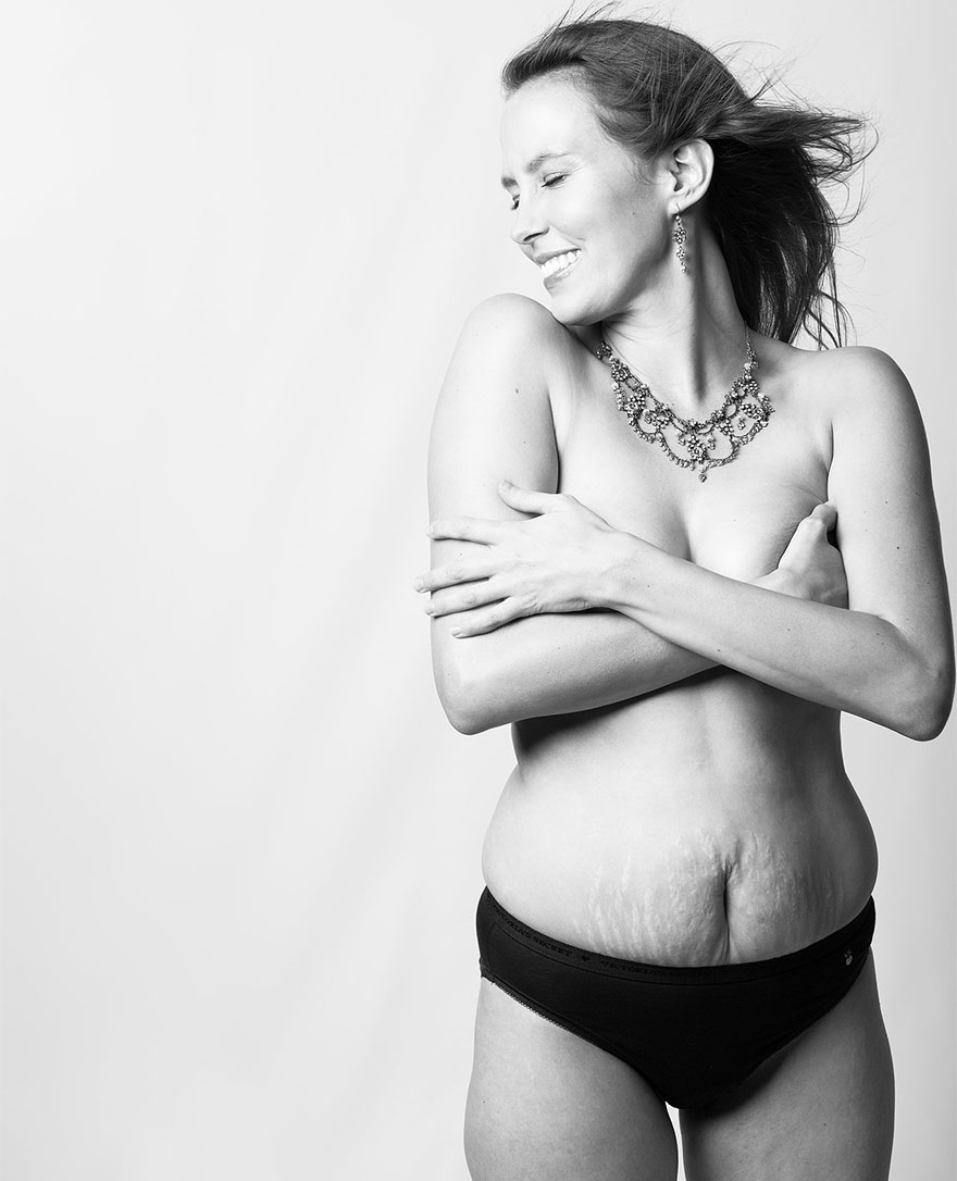 Doğum Sonrası Kadın Vücudunun Ne Hale Geldiğini Gösteren 14 Fotoğraf galerisi resim 3