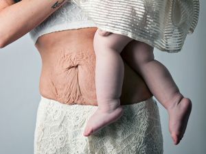 Doğum Sonrası Kadın Vücudunun Ne Hale Geldiğini Gösteren 14 Fotoğraf
