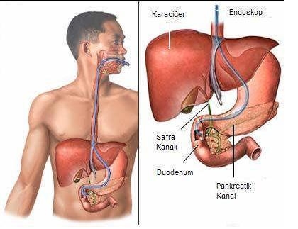 DÖRT AY İÇERİSİNDE KARACİĞERİ TEMİZLEMEK MÜMKÜN !!! galerisi resim 4