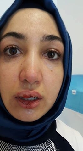 Makasla saldırıp yerde sürüklediler! galerisi resim 5