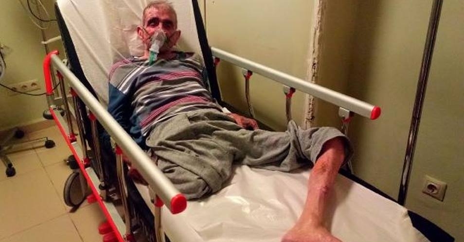 Oksijen maskesiyle sigara içmeye çalıştı, kendini yaktı! galerisi resim 2