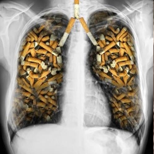 Oksijen maskesiyle sigara içmeye çalıştı, kendini yaktı! galerisi resim 4