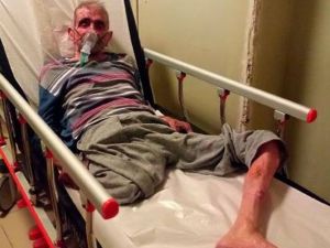 Oksijen maskesiyle sigara içmeye çalıştı, kendini yaktı!