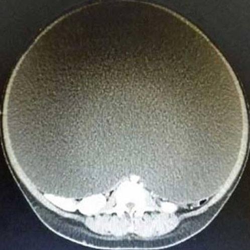 Hamile olduğunu düşünüyordu, doktora gittiğinde büyük şok yaşadı! galerisi resim 2