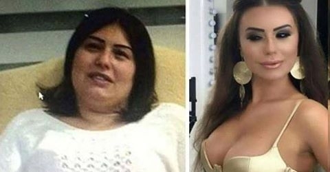 Kilo almaya dur' dedi 6 ayda 46 kilo verdi galerisi resim 1