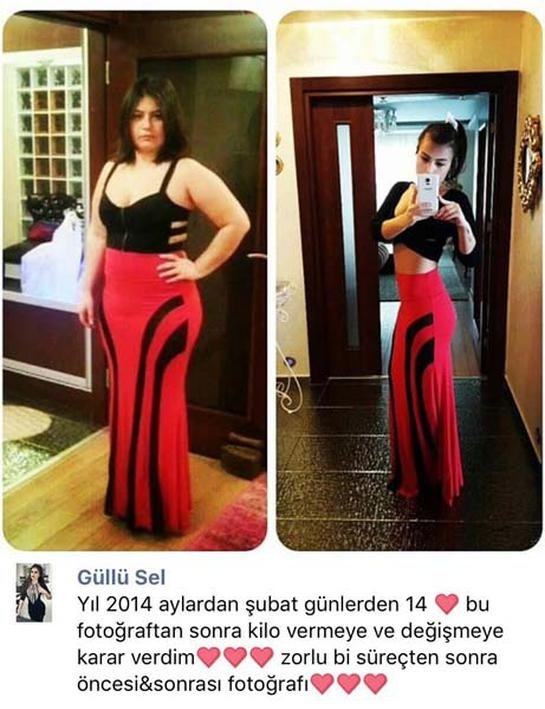 Kilo almaya dur' dedi 6 ayda 46 kilo verdi galerisi resim 5