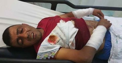 Kendisini parçalamak isteyen köpeğini suda boğarak ölümden kurtuldu galerisi resim 1