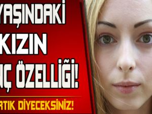 21 Yaşındaki Kızın Özelliğine İnanamayacaksınız!