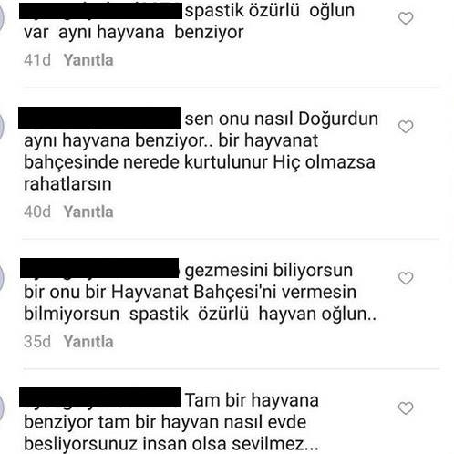 Özürlü çocuğuna bunlar söylenince çılgına döndü galerisi resim 2