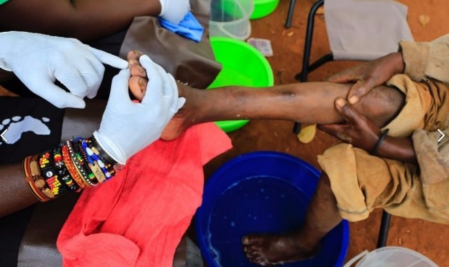 Ayağında Öyle Bir Şey Tespit Edildi Ki Şok Olacaksınız..! galerisi resim 1