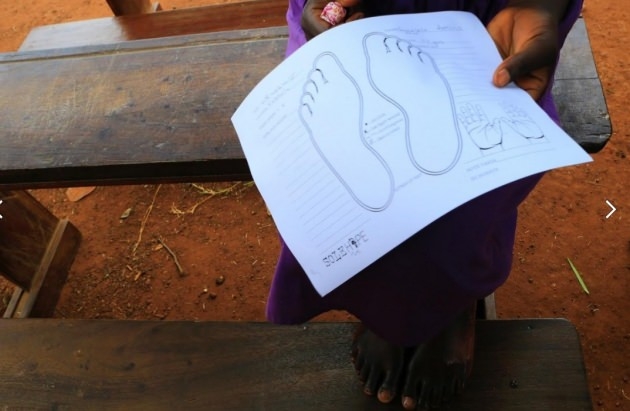 Ayağında Öyle Bir Şey Tespit Edildi Ki Şok Olacaksınız..! galerisi resim 3