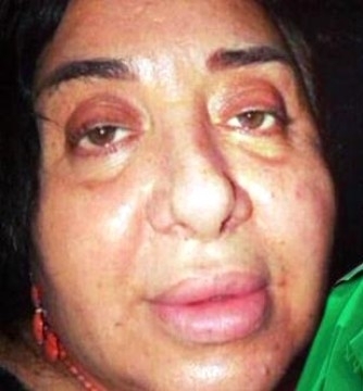 Aniden fenalaşmıştı! Hastaneden Nur Yerlitaş açıklaması geldi... galerisi resim 4