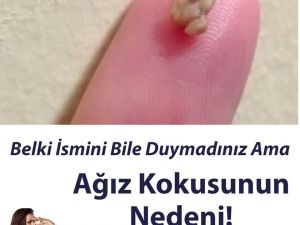 Belki İsmini Bile Duymadınız Ama.. İşte Ağız Kokusunun Nedeni!