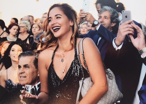 Survivor Berna'nın son haline bakın böyle değişim görülmedi! galerisi resim 7