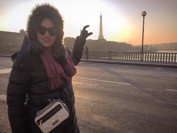 Ezgi Mola'nın son haline bakın değişimi şoke edecek! galerisi resim 10