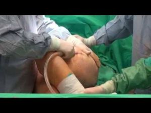 İzmit'te yağ aldırma ameliyatı olan kadın 1 gün sonra öldü