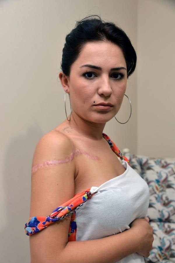 Şu hale bakın! Dövmelerinden kurtulmak istedi hayatı karardı galerisi resim 3