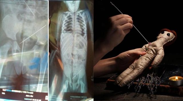 Voodoo Büyüsü İçin 3 Yaşındaki Çocuğu Kullandı! galerisi resim 1