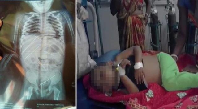 Voodoo Büyüsü İçin 3 Yaşındaki Çocuğu Kullandı! galerisi resim 2