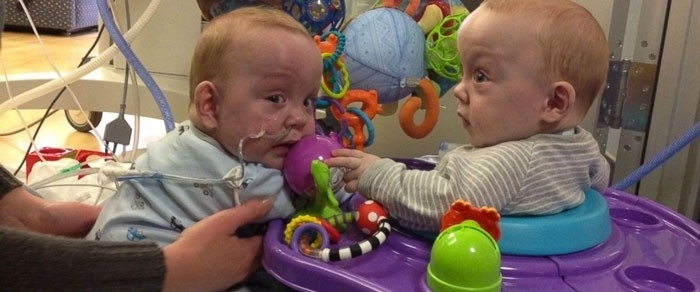 Doktor bebeğin karnındaki şişliği fark etti ve şoke oldu galerisi resim 3