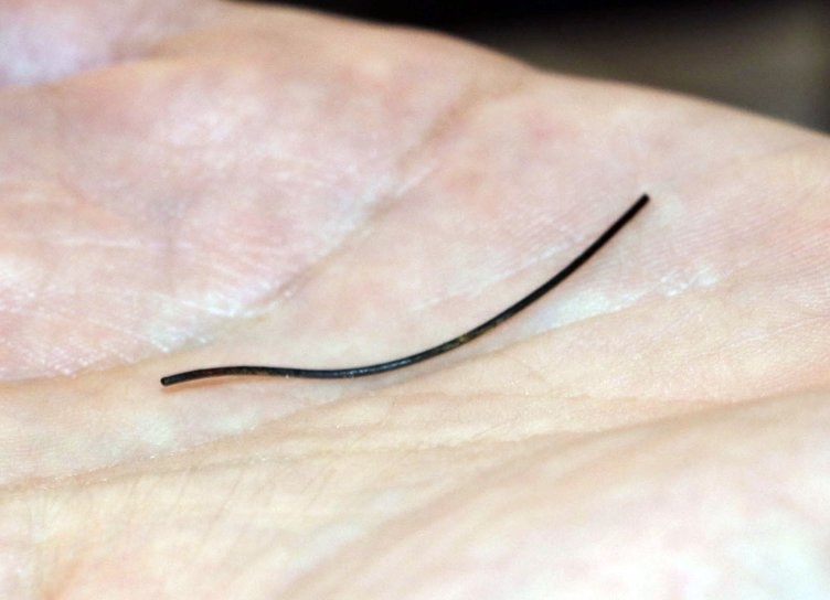 Petek bal yiyen kadının midesinden çıktı! galerisi resim 3