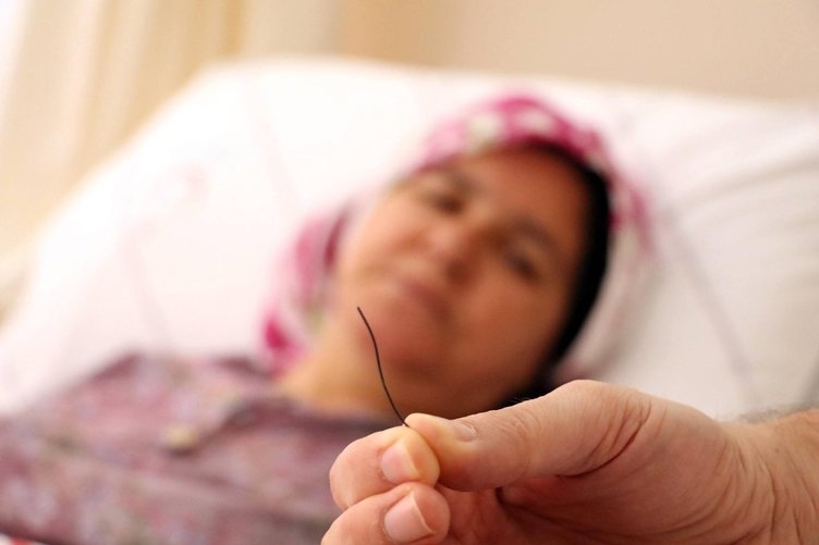 Petek bal yiyen kadının midesinden çıktı! galerisi resim 4