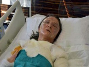 Kayınvalide Gelinini bu Hale Getirdi…