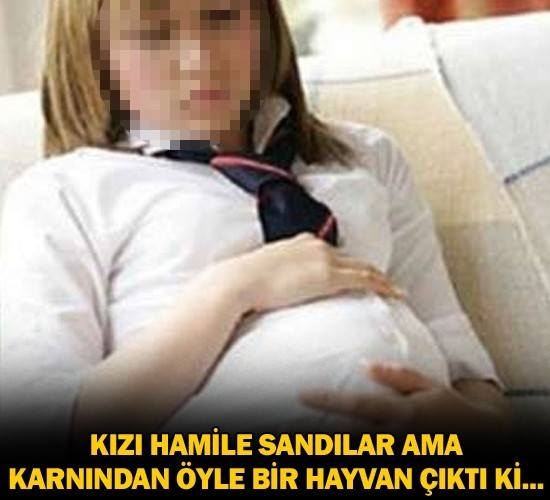 Hamile Sandılar Ama Karnından Öyle Bir Hayvan Çıktı Ki... galerisi resim 1