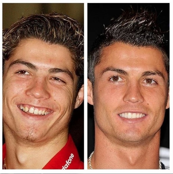 Fotoğraftaki küçük kızları tanıdınız mı? Şimdilerde fırtınalar estiriyor galerisi resim 2