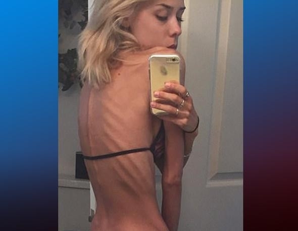 İki sene önce ölmek üzereydi şimdi ise... Son haline bakın! galerisi resim 1