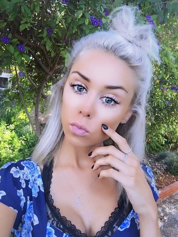 İki sene önce ölmek üzereydi şimdi ise... Son haline bakın! galerisi resim 5