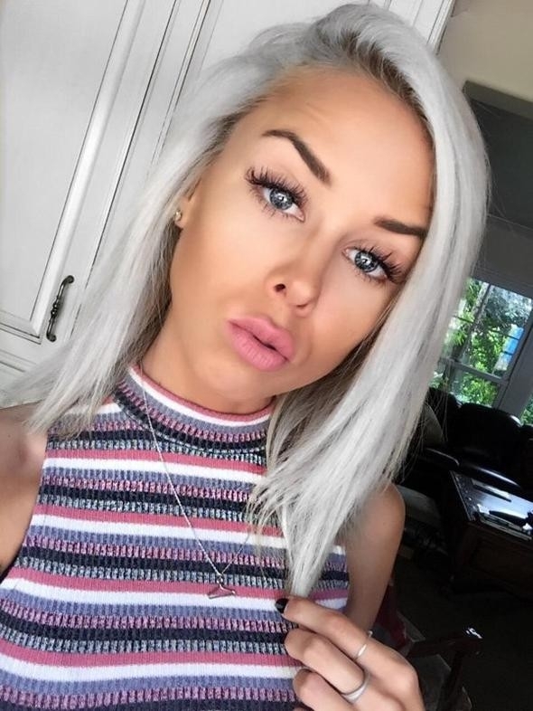 İki sene önce ölmek üzereydi şimdi ise... Son haline bakın! galerisi resim 6