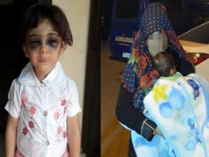 Üvey anne mağduru çocuğun öz annesi konuştu