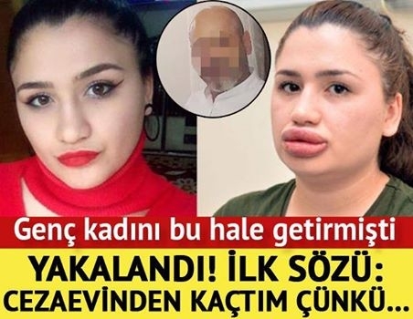 Cezaevinden firar eden sahte estetikçi yakalandı! İlk sözü ise... galerisi resim 1