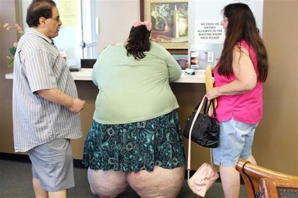 Böylesini hiç görmediniz! Tam 200 kilo verdi galerisi resim 3